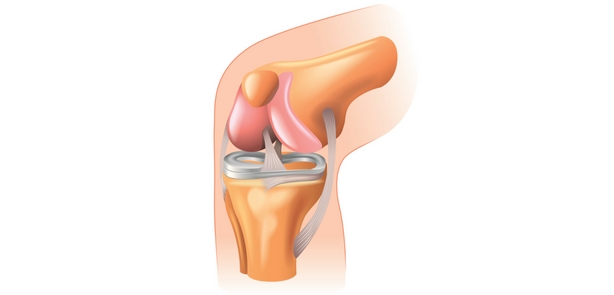 inflamația articulațiilor picioarelor unguent tratament inflamația meniscului cauzează simptomele genunchiului